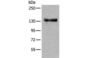 Western blot analysis of Mouse brain tissue lysate using PTPRA Polyclonal Antibody at dilution of 1:400 (PTPRA anticorps)