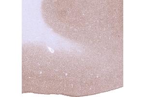 Strong GAD2 staining of nerve fibres in the grey matter of the cerebrum