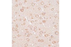Immunohistochemistry of paraffin-embedded rat brain using KCNJ4 antibody (ABIN6134096, ABIN6142734, ABIN6142737 and ABIN6218214) at dilution of 1:100 (40x lens). (KCNJ4 anticorps  (AA 50-150))