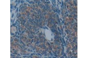 IHC-P analysis of Rat Tissue, with DAB staining. (PZP anticorps  (AA 1251-1500))
