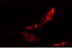 ABIN6275120 staining  HeLa cells by IF/ICC. (EIF3K anticorps  (N-Term))