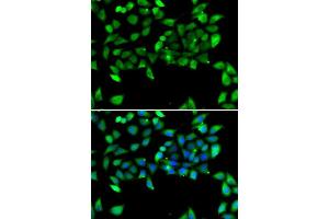 Immunofluorescence analysis of U2OS cells using EIF3H antibody. (EIF3H anticorps  (AA 80-340))