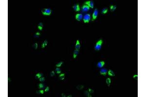 Immunofluorescence staining of Hela cells with ABIN7149348 at 1:133, counter-stained with DAPI. (CPEB4 anticorps  (AA 244-515))