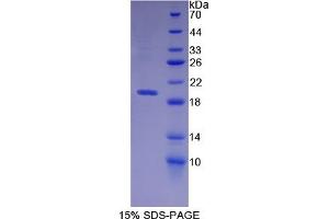 SDS-PAGE of Protein Standard from the Kit  (Highly purified E. (MME Kit ELISA)