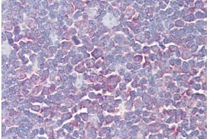 Image no. 2 for anti-PTK2B Protein tyrosine Kinase 2 beta (PTK2B) (AA 812-861) antibody (ABIN1500493)