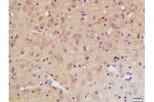Formalin-fixed and paraffin embedded rat brain labeled with Rabbit Anti-PTPN11 (Tyr584) Polyclonal Antibody, Unconjugated 1:200 followed by conjugation to the secondary antibody and DAB staining