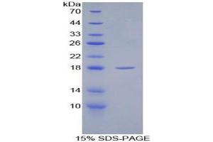 SDS-PAGE analysis of Rat SFRP1 Protein. (SFRP1 Protéine)