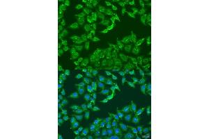 Immunofluorescence analysis of U2OS cells using  antibody  at dilution of 1:100.