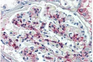 Human Kidney: Formalin-Fixed, Paraffin-Embedded (FFPE) (METTL7B anticorps  (C-Term))