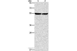 Western blot analysis of Mouse heart tissue and hela cell, using ILK Polyclonal Antibody at dilution of 1:600 (ILK anticorps)