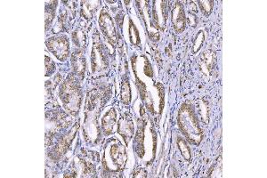 IHC analysis of TOM1L1 using anti-TOM1L1 antibody (ABIN7602631). (TOM1L1 anticorps  (AA 9-448))