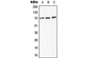 Western blot analysis of GABRA4 expression in MCF7 (A), SP2/0 (B), PC12 (C) whole cell lysates. (GABRA4 anticorps  (Center))