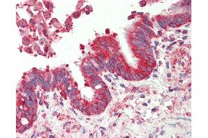 Anti-TSPAN12 antibody IHC staining of human lung, respiratory epithelium.