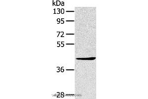 Western blot analysis of A431 cell, using TNIP2 Polyclonal Antibody at dilution of 1:500 (TNIP2 anticorps)