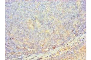 anti-C-Mer Proto-Oncogene Tyrosine Kinase (MERTK) (AA 840-999) antibody