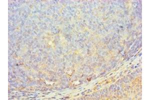 Immunohistochemistry of paraffin-embedded human tonsil tissue using ABIN7174047 at dilution of 1:100 (MERTK anticorps  (AA 840-999))