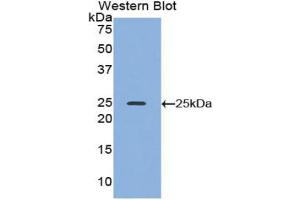Western blot analysis of the recombinant protein. (ADH1 anticorps  (AA 25-228))