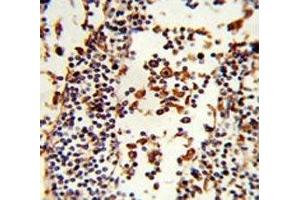 IHC analysis of FFPE human lymph tissue stained with IGHA1 antibody (IGHA1 anticorps  (AA 257-286))