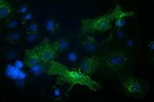 Anti-VCAM1 mouse monoclonal antibody (ABIN2454232) immunofluorescent staining of COS7 cells transiently transfected by pCMV6-ENTRY VCAM1 (RC209761). (VCAM1 anticorps)