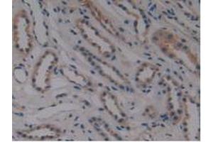 Detection of MPP6 in Human Kidney Tissue using Polyclonal Antibody to Membrane Protein, Palmitoylated 6 (MPP6) (MPP6 anticorps  (AA 331-503))