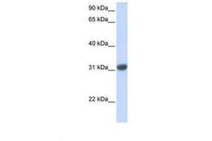 Image no. 1 for anti-Orthodenticle Homeobox 2 (OTX2) (AA 110-159) antibody (ABIN6737647) (OTX2 anticorps  (AA 110-159))