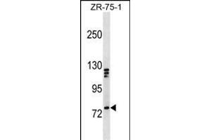KIF3A Antibody (C-term) (ABIN1537505 and ABIN2850289) western blot analysis in ZR-75-1 cell line lysates (35 μg/lane). (KIF3A anticorps  (C-Term))