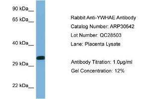 WB Suggested Anti-YWHAE Antibody   Titration: 1. (YWHAE anticorps  (C-Term))