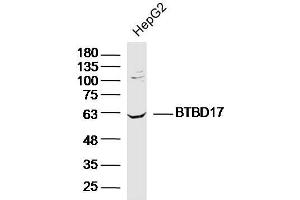 Lane 1: HepG2 lysates probed with BTBD17 Polyclonal Antibody, Unconjugated  at 1:300 overnight at 4˚C. (BTBD17 anticorps  (AA 101-200))