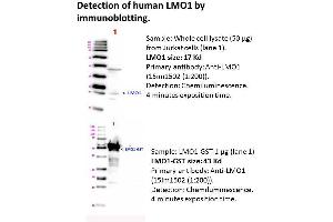 Image no. 1 for anti-LIM Domain Only 1 (Rhombotin 1) (LMO1) antibody (ABIN1112421)