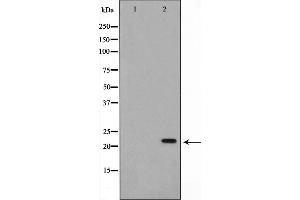 Western blot analysis on K562 cell lysate using NM23 Antibody. (NME2 anticorps  (Internal Region))