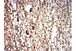 Immunohistochemical analysis of paraffin-embedded human medulla oblongata tissues using NEFH mouse mAb with DAB staining. (NEFH anticorps  (AA 2-251))