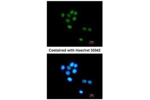 ICC/IF Image Immunofluorescence analysis of methanol-fixed HepG2, using TULP3, antibody at 1:200 dilution. (TULP3 anticorps)