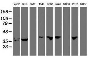 Image no. 4 for anti-Exoribonuclease 1 (ERI1) antibody (ABIN1498094)