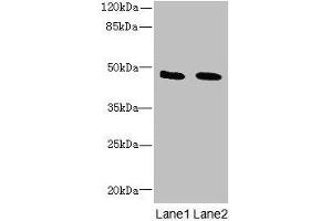 Western blot All lanes: IGSF11 antibody at 1. (IGSF11 anticorps  (AA 23-241))