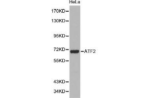 Western Blotting (WB) image for anti-Activating Transcription Factor 2 (ATF2) (AA 1-190) antibody (ABIN6219371) (ATF2 anticorps  (AA 1-190))