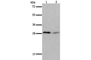 Western Blot analysis of Mouse brain and kidney tissue using KLK7 Polyclonal Antibody at dilution of 1:600 (Kallikrein 7 anticorps)