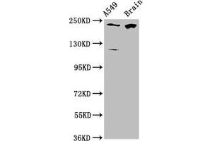 Western Blot Positive WB detected in: A549 whole cell lysate, Rat brain tissue All lanes: CABIN1 antibody at 3. (CABIN1 anticorps  (AA 1978-2123))