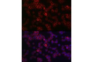 Immunofluorescence analysis of Jurkat cells using CD45 Rabbit pAb (ABIN3022953, ABIN3022954, ABIN3022955, ABIN1513451 and ABIN6219315) at dilution of 1:100 (40x lens). (CD45 anticorps  (AA 890-990))