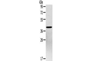 Western Blotting (WB) image for anti-Pentraxin 3 (PTX3) antibody (ABIN2434027) (PTX3 anticorps)