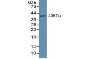 WB of Protein Standard: different control antibodies against Highly purified E. (PINP Kit ELISA)