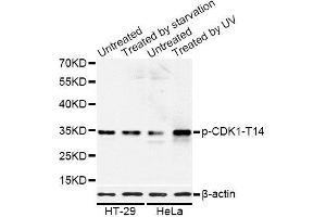 Western blot analysis of extracts of HT-29 and HeLa cells, using Phospho-CDK1-T14 antibody (ABIN5969876) at 1/1000 dilution. (CDK1 anticorps  (pThr14))