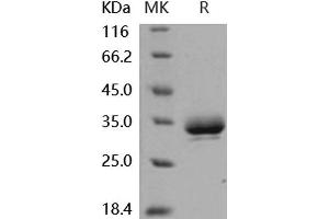 Erythropoietin Receptor (EPOR) (Active) protein (His tag)
