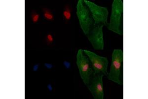 ABIN6265491 and ABIN6266698 staining  cells by IF/ICC. (TBX2/3 (Internal Region) anticorps)
