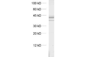 dilution: 1 : 1000, sample: crude synaptosomal fraction of rat brain (P2) (Syntaxin 16 anticorps  (AA 1-302))