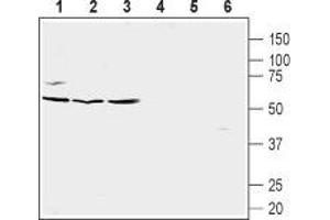 Western blot analysis of Burkitt's lymphoma (Raji) (lanes 1 and 4), human prostate carcinoma (LNCaP) (lanes 2 and 5) and human prostate carcinoma (PC-3) cell line lysates (lanes 3 and 6): - 1-3. (CXCR5 anticorps  (Extracellular, N-Term))