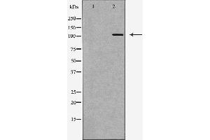 Western blot analysis of Hela whole cell lysates, using PARP1 Antibody. (PARP1 anticorps  (Internal Region))
