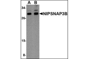 Western blot analysis of NIPSNAP3B in mouse brain tissue lysate with this product at (A) 1 and (B) 2 μg/ml. (NIPSNAP3B anticorps  (Center))