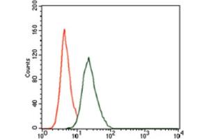 Immunohistochemical analysis of paraffin-embedded cervical cancer tissues using RUNX3 antibody with DAB staining.