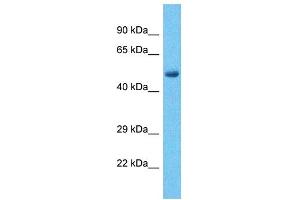 Host:  Rabbit  Target Name:  PHF15  Sample Type:  Liver Tumor lysates  Antibody Dilution:  1. (PHF15 anticorps  (C-Term))