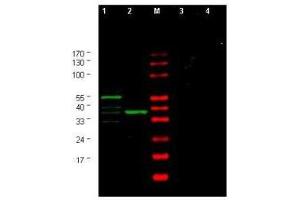 Western blot using  Affinity Purified anti-Yeast CHK1 antibody shows detection of a bands corresponding to CHK1 in Saccharomyces cerevisiae lysates. (CHEK1 anticorps  (AA 312-327))